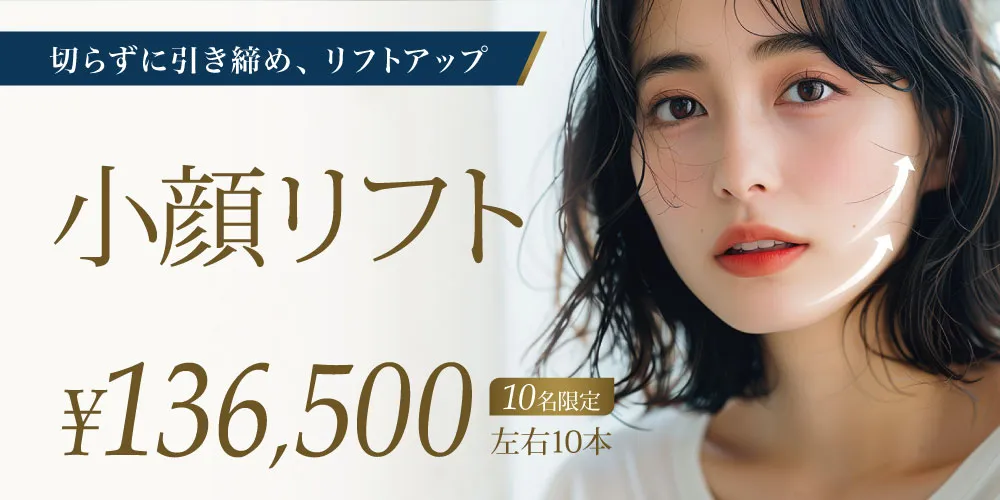 糸リフト