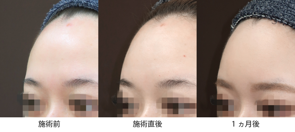 症例写真斜め