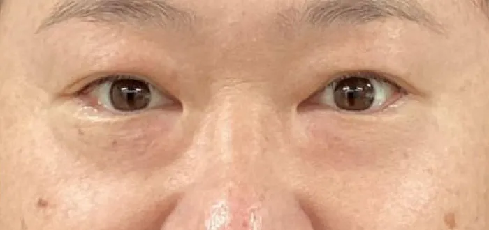 治療前