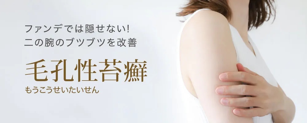 毛孔性苔癬