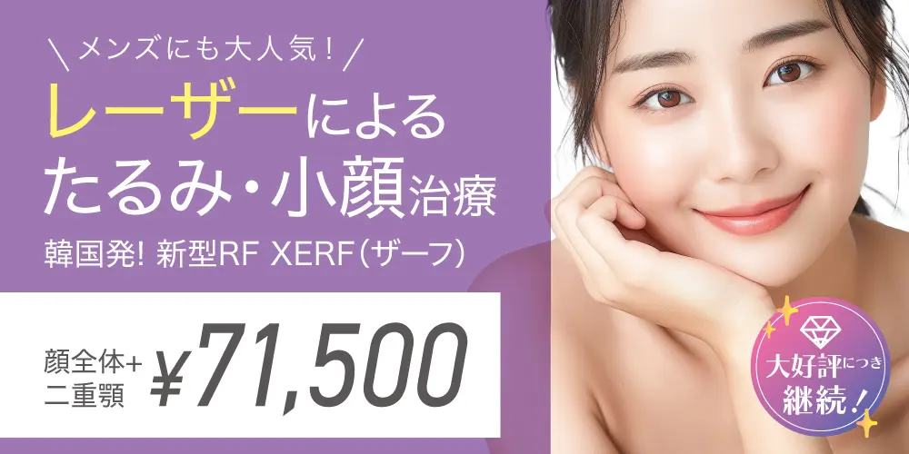 新型RF　XERF（ザーフ）