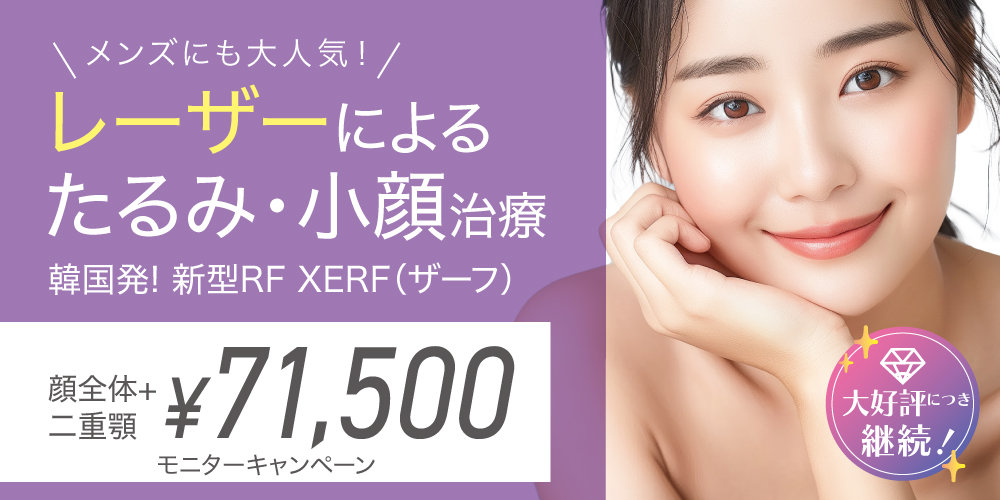 新型RF　XERF（ザーフ）