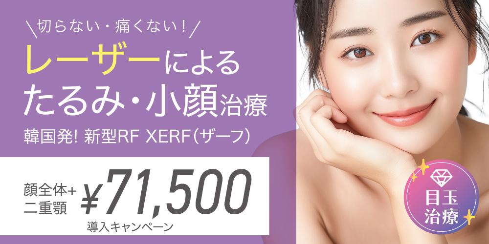新型RF XERF(ザーフ)